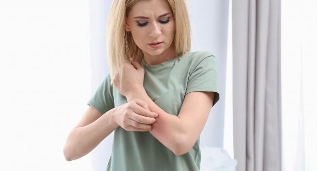 Allergie in menopausa: le reazioni cutanee possono aumentare? '