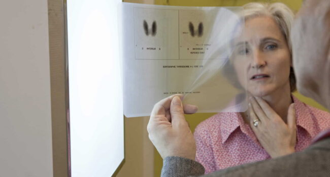 Disturbi della tiroide in menopausa '