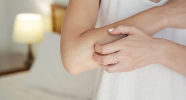 Pelle secca e prurito su tutto il corpo: non solo nella zona intima '